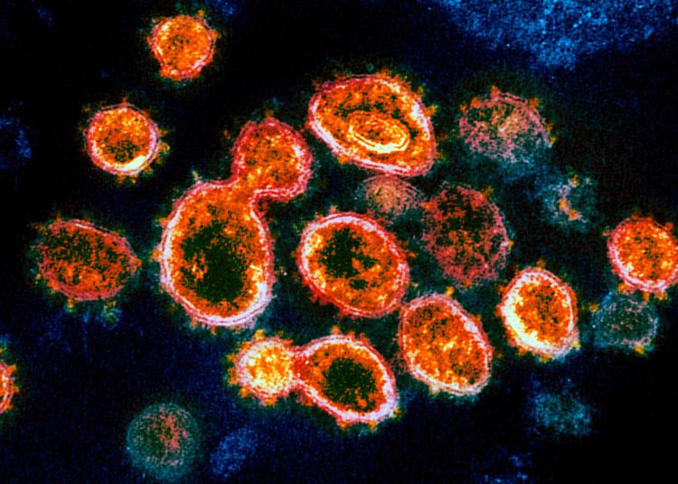 Tres fármacos combaten el coronavirus con un éxito de "casi el 100%" en laboratorio de Jerusalén