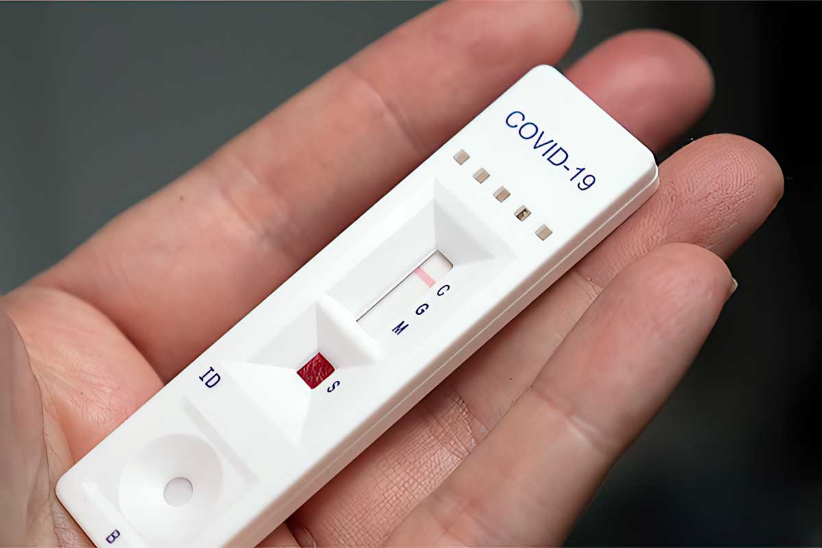 israel-lanza-piloto-para-vender-pruebas-caseras-de-covid-19-en-farmacias