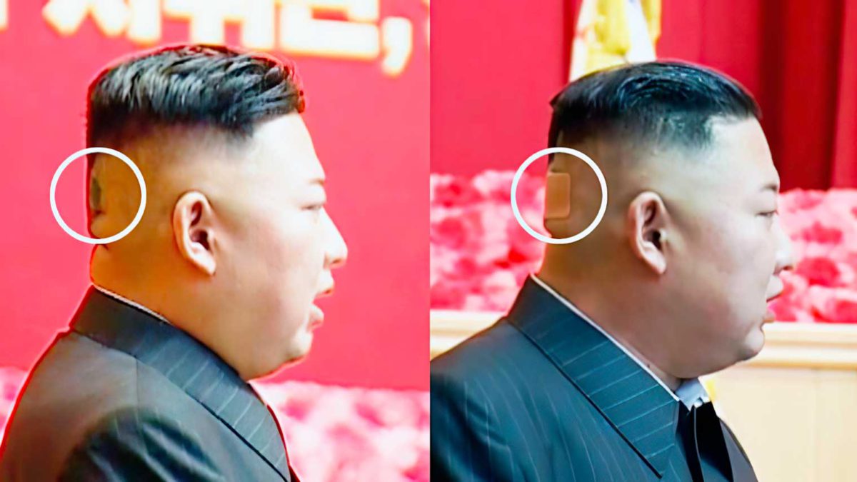 Kim Jong Un reaparece con un vendaje en la cabeza
