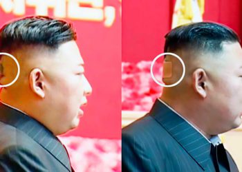 Kim Jong Un reaparece con un vendaje en la cabeza