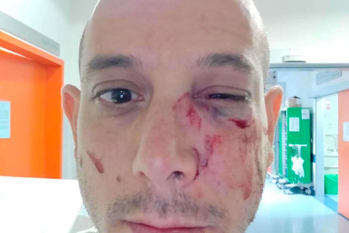 Turista israelí víctima de una agresión antisemita en Italia