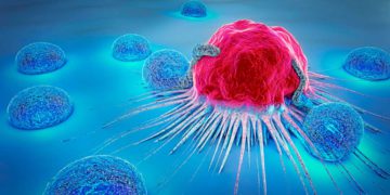 Estudio israelí sobre el cáncer revela un posible avance en inmunoterapia