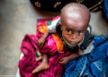 Niños del Congo viajarán Israel para una operación cardíaca que les salvará la vida