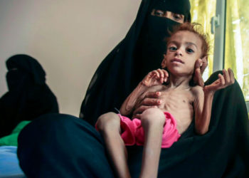Cinco millones de personas en Yemen están al borde de la hambruna
