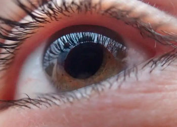 Médicos israelíes devuelven la visión a una mujer ciega en un procedimiento innovador