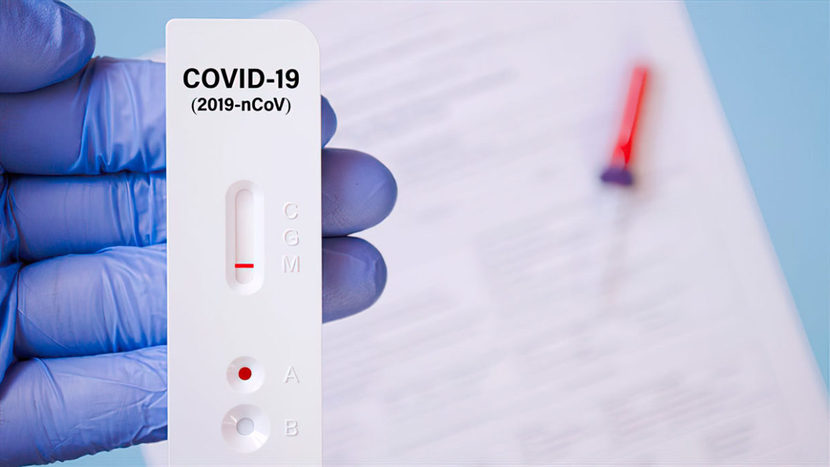 COVID-19: Israel expandirá la comercialización de pruebas de antígenos