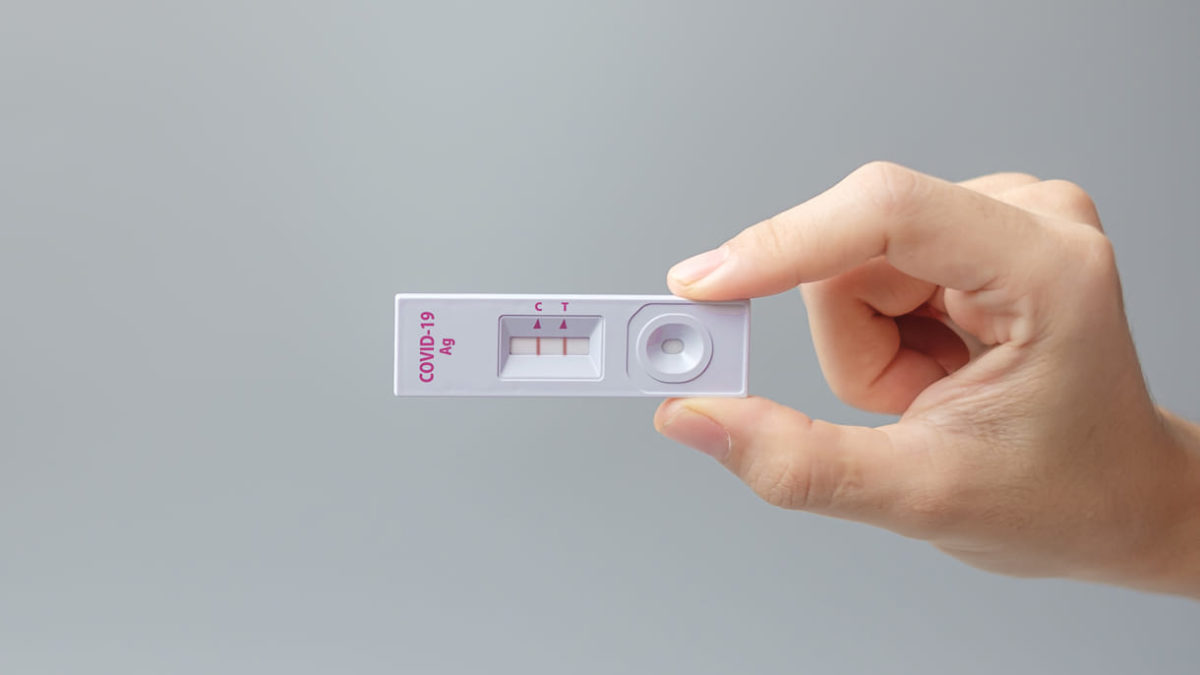 Bajan los precios de los kits de pruebas caseras de antígenos en Israel