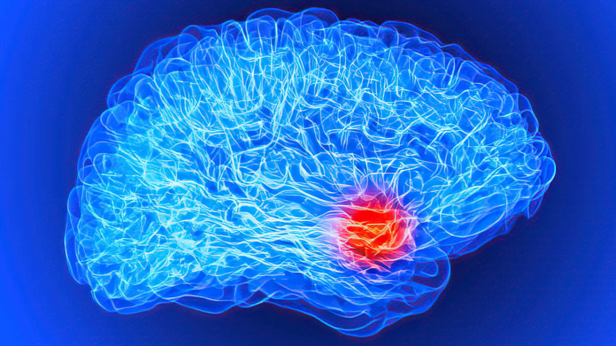 Se podría haber encontrado el origen de la esquizofrenia en el cerebro
