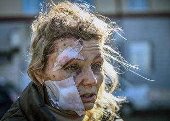 Ucraniana que sobrevivió al ataque con misiles de Rusia: “debo tener un ángel de la guarda”