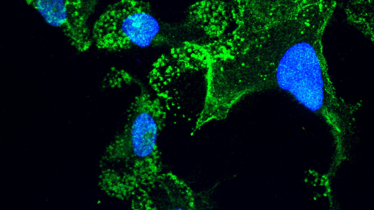 Células inmunitarias en el cerebro de pacientes con ELA, con el núcleo celular en azul. El equipo de investigación del Instituto de Ciencias Weizmann ha descubierto una mutación genética que reduce su toxicidad y, por tanto, la degeneración cerebral (Instituto de Ciencias Weizmann)