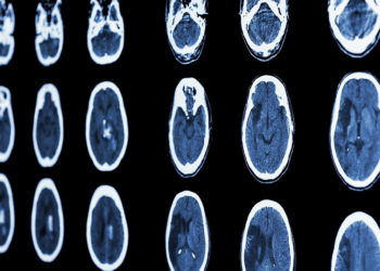 Viz.ai de Israel detecta enfermedades cerebrales con inteligencia artificial