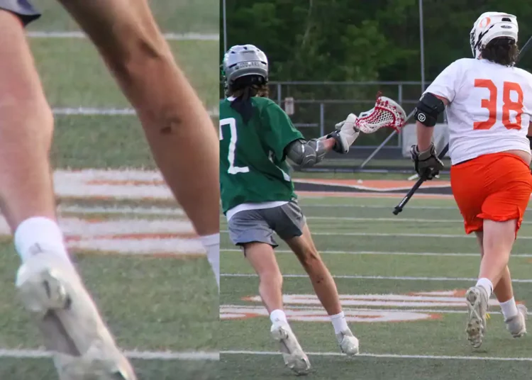 Un jugador de lacrosse del instituto de Cleveland sale al campo con una esvástica en la pierna