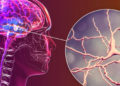 Células cerebrales específicas relacionadas con la enfermedad de Parkinson