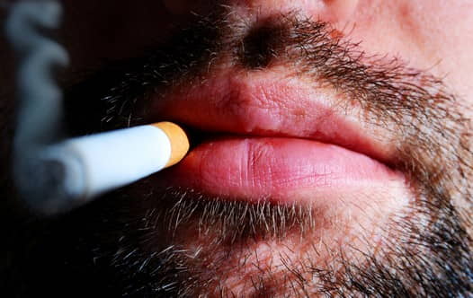 Así afecta el tabaco a los dientes, la boca y las encías