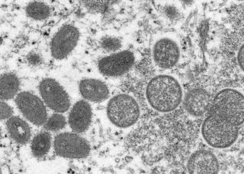 Esta imagen de microscopio electrónico de 2003 proporcionada por los Centros para el Control y la Prevención de Enfermedades muestra viriones maduros de viruela del simio de forma ovalada, a la izquierda, y viriones inmaduros esféricos, a la derecha, obtenidos de una muestra de piel humana. (Cynthia S. Goldsmith, Russell Regner/CDC vía AP)