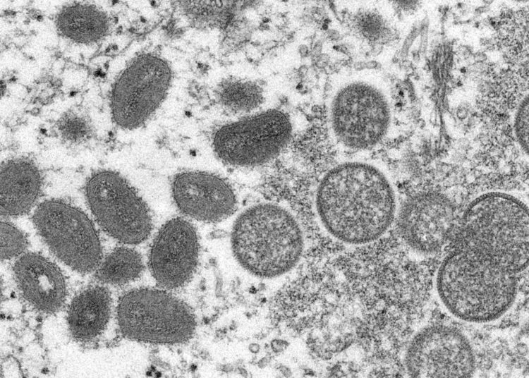 Esta imagen de microscopio electrónico de 2003 proporcionada por los Centros para el Control y la Prevención de Enfermedades muestra viriones maduros de viruela del simio de forma ovalada, a la izquierda, y viriones inmaduros esféricos, a la derecha, obtenidos de una muestra de piel humana. (Cynthia S. Goldsmith, Russell Regner/CDC vía AP)