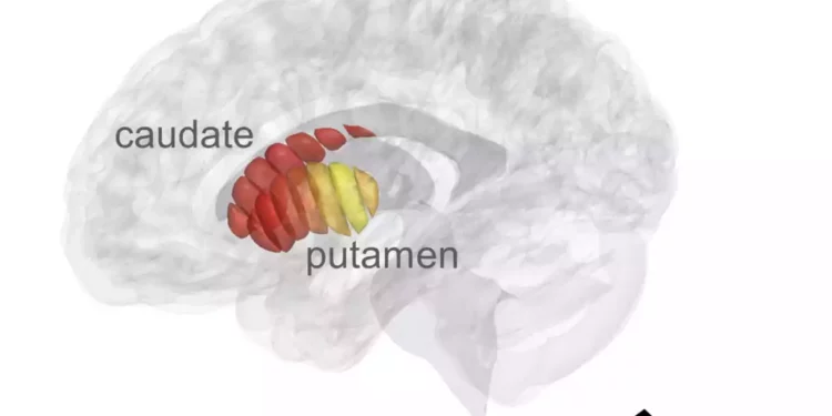 Laboratorio israelí desarrolla un escáner cerebral para la detección temprana del Parkinson