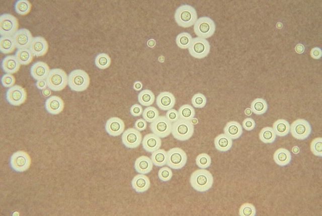 Investigadores identifican un hongo que desarrolla resistencia a los medicamentos