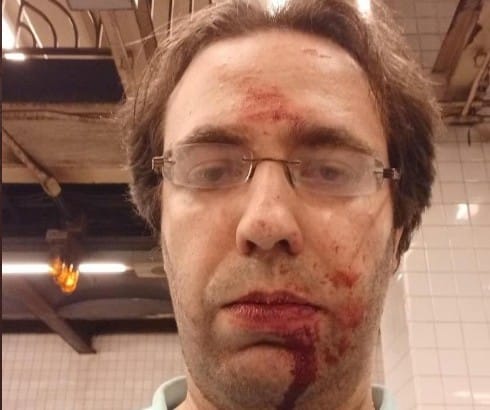 Mujer judía es asfixiada en el metro de Nueva York en un ataque antisemita