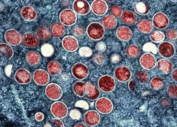 Por primera vez se diagnostica viruela símica a una mujer en Israel