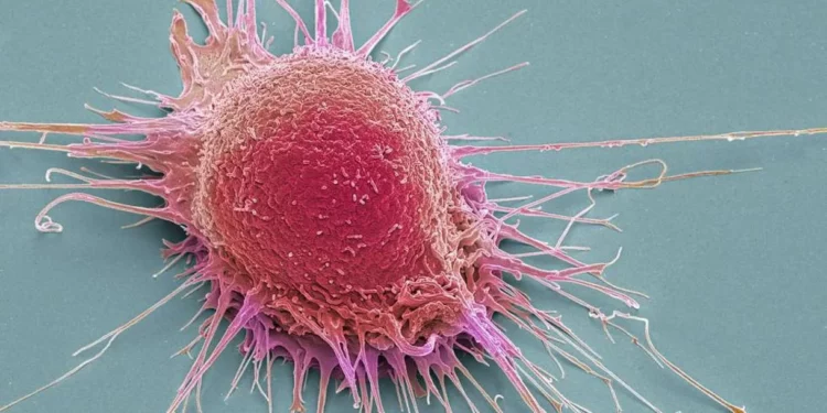 Científicos israelíes lideran la búsqueda de tratamientos contra el cáncer