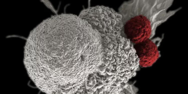 ¿Se puede diagnosticar el cáncer haciendo una biopsia líquida?