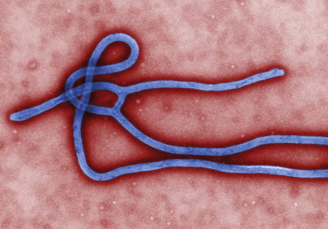 El Ministerio de Sanidad de Uganda confirma un brote de ébola