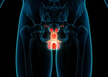 La tasa de supervivencia del cáncer de próstata en Israel es una de las más altas del mundo
