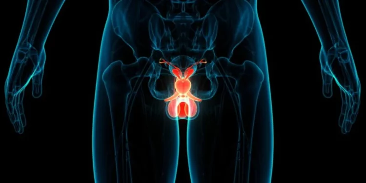 La tasa de supervivencia del cáncer de próstata en Israel es una de las más altas del mundo