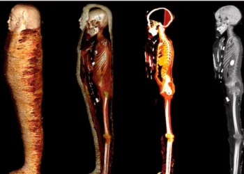Una momia de 2.300 años se somete a una tomografía computarizada