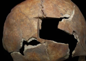 Descubren en Israel la cirugía cerebral más antigua de Oriente Próximo
