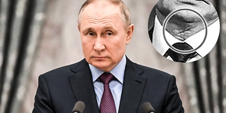 Tema: Putin y la cicatriz: ¿rumores de enfermedad resurgen?