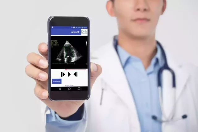 Philips compra la empresa israelí DiA Imaging Analysis