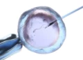 Posible Confusión de Embriones en la Clínica Assuta: Preocupación por Fecundaciones in Vitro