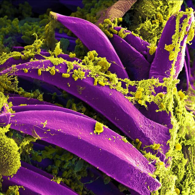 Científicos hallan pruebas de la peste bubónica en la Antigua Inglaterra