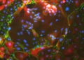Universidad Hebrea convierte células de piel en células placentarias