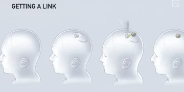 Neuralink de Musk busca voluntarios para implantes cerebrales