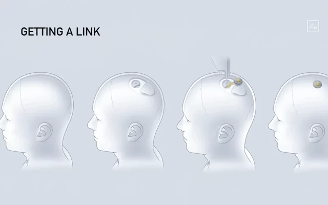 Neuralink de Musk busca voluntarios para implantes cerebrales