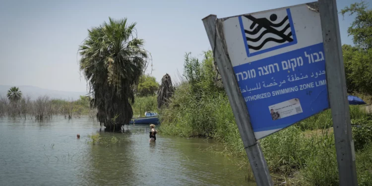 Preocupación en Israel por peligrosa ameba “comecerebros”