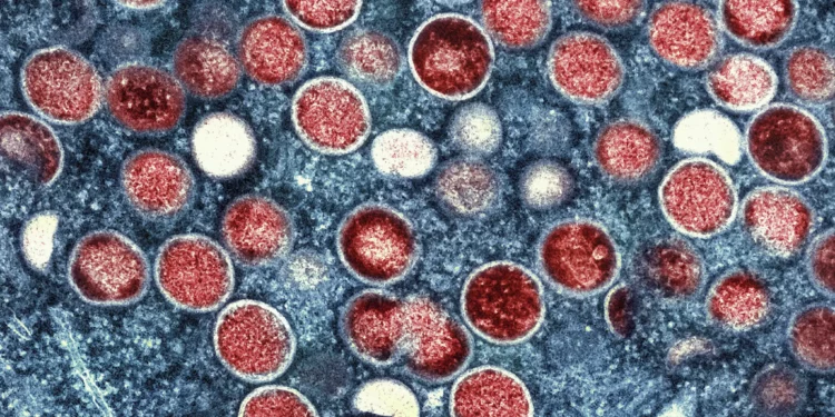 Esta imagen proporcionada por el Instituto Nacional de Alergias y Enfermedades Infecciosas (NIAID) muestra una micrografía electrónica de transmisión coloreada de partículas de viruela del simio (rojas) encontradas dentro de una célula infectada (azul), cultivada en el laboratorio que fue capturada y mejorada en color en el Centro de Investigación Integrada (IRF) del NIAID en Fort Detrick, Maryland. (NIAID vía AP, Archivo)