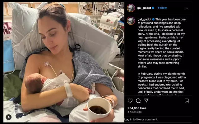 Gal Gadot tuvo cirugía cerebral urgente estando embarazada de 8 meses