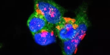 Israel desarrolla análisis de sangre para detectar Parkinson precoz