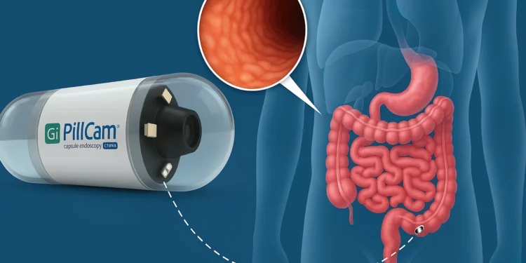 Tecnología israelí PillCam alcanza 3 millones de usos