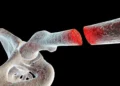 PeptOss: avance israelí que combina regeneración ósea y terapia