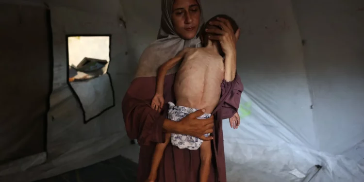 Hidaya, una madre palestina de 31 años, acuna a su hijo Mohammed al-Mutawaq, de 18 meses, enfermo y con síntomas de desnutrición, dentro de su tienda de campaña en el campo de refugiados de Al-Shati, al oeste de la ciudad de Gaza, el 24 de julio de 2025. Este pie de foto se actualizó el 30 de julio de 2025 para reflejar nueva información sobre el estado de Al-Mutawaq (Omar AL-QATTAA / AFP).