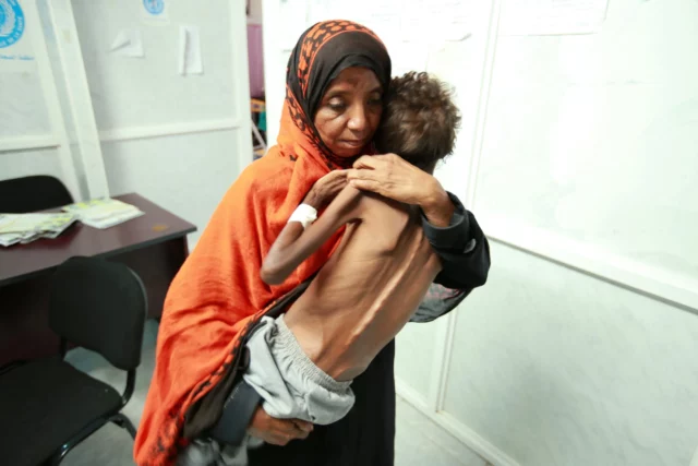 85.000 niños murieron de hambre en Yemen: ¿no te enteraste?