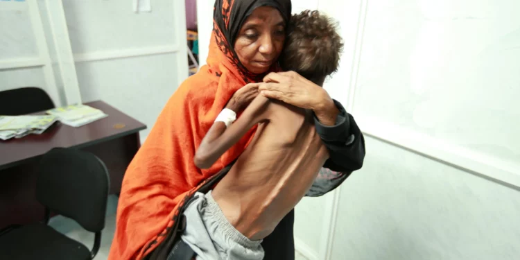 85.000 niños murieron de hambre en Yemen: ¿no te enteraste?
