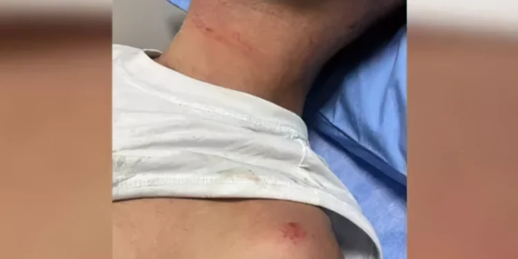 Atacan a tres israelíes en Tailandia tras oírlos hablar hebreo