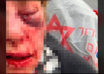 Superviviente del Holocausto que fue atacada: “Podía haberme asesinado”