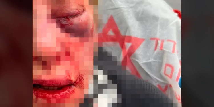 Superviviente del Holocausto que fue atacada: “Podía haberme asesinado”